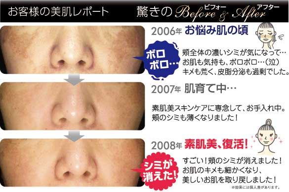お客様レポート驚きのBefore&After